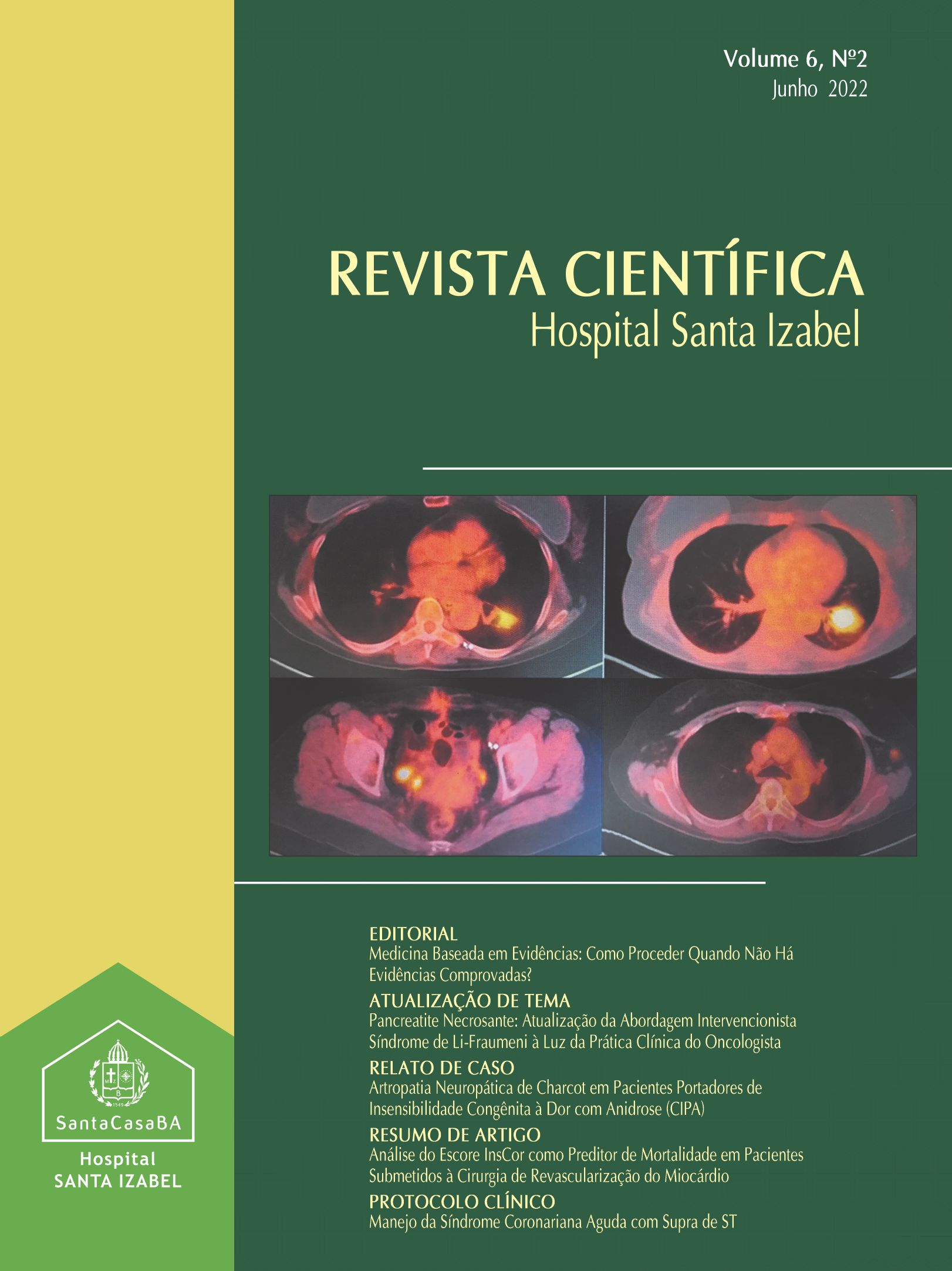           Visualizar v. 6 n. 2 (2022): Revista Científica Hospital Santa Izabel
        