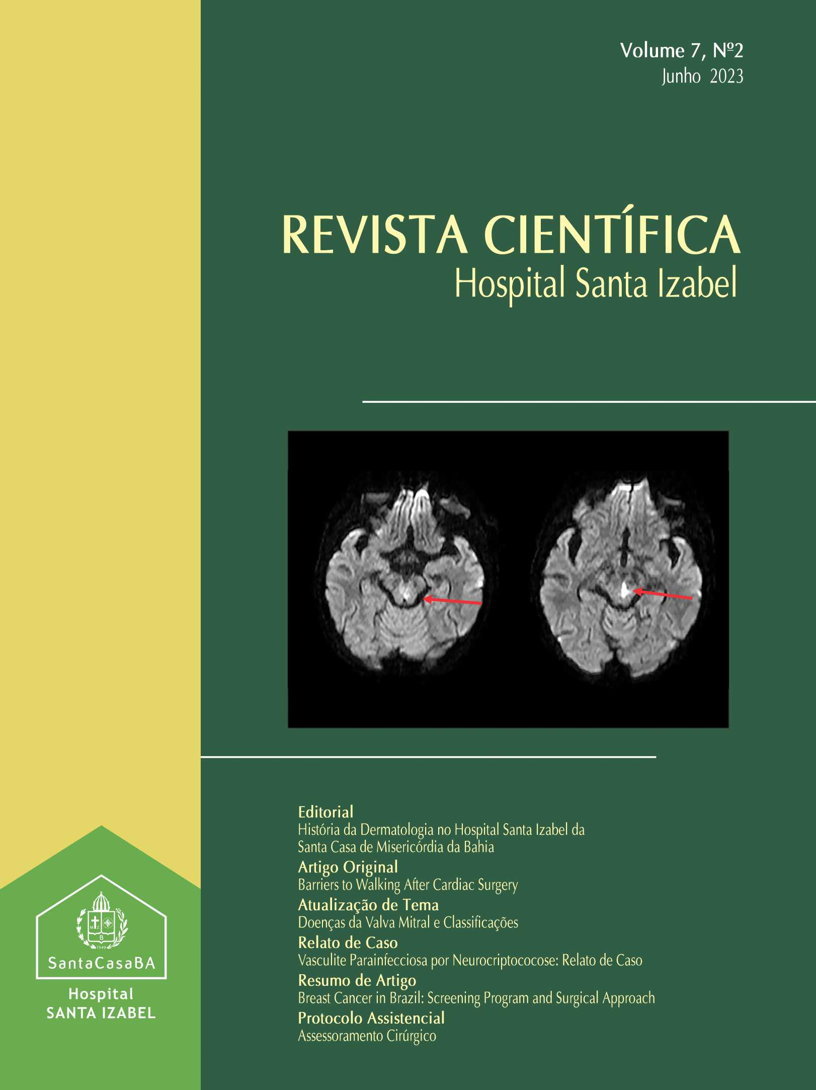					Visualizar v. 7 n. 2 (2023): Revista Científica Hospital Santa Izabel
				